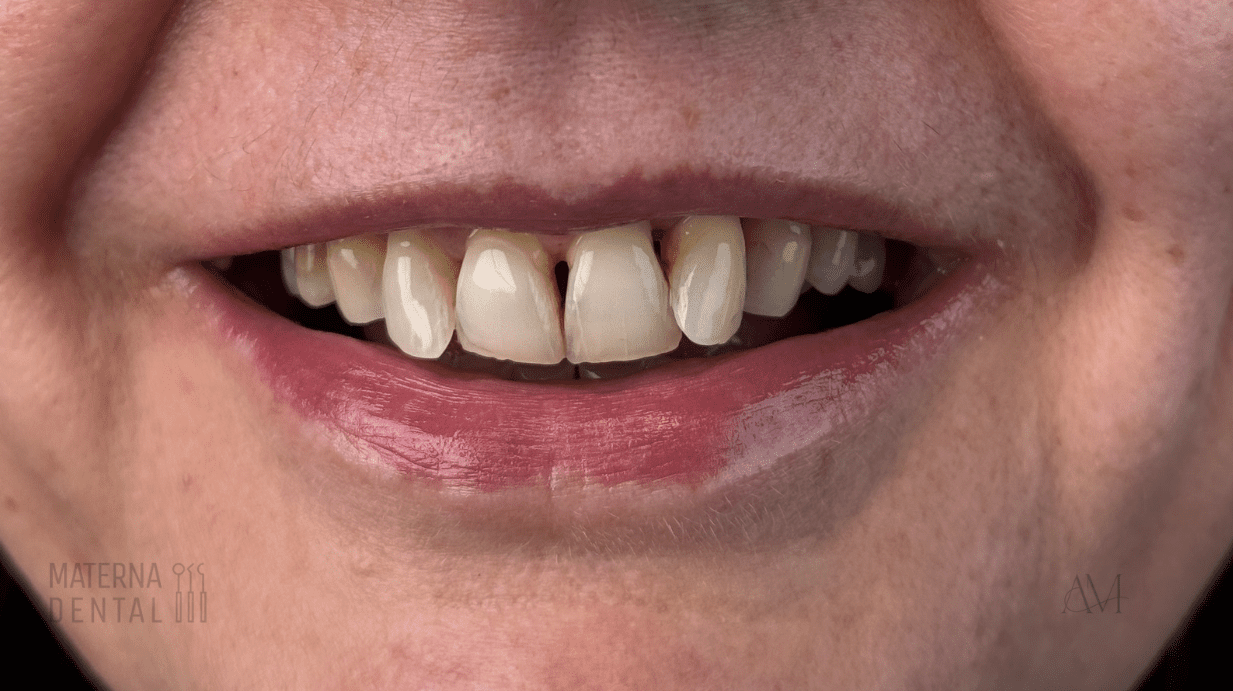 Zrzut ekranu 2026-01-12 110045